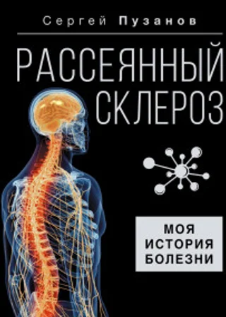 Рассеянный склероз. Моя история болезни